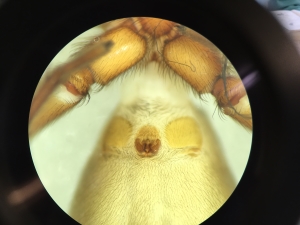 Examining an epigyne under a microscope.  C Bell